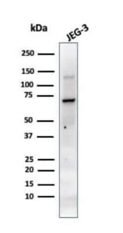 Alkaline Phosphatase/ALPP Antibody (PL8-F6), Novus Biologicals:Antibodies:Primary