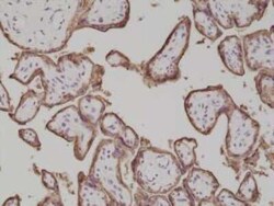 Alkaline Phosphatase/ALPP Antibody (RM317), Novus Biologicals 100 &mu;g;