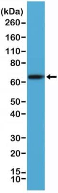 Alkaline Phosphatase/ALPP Antibody (RM317), Novus Biologicals 100 &mu;g;