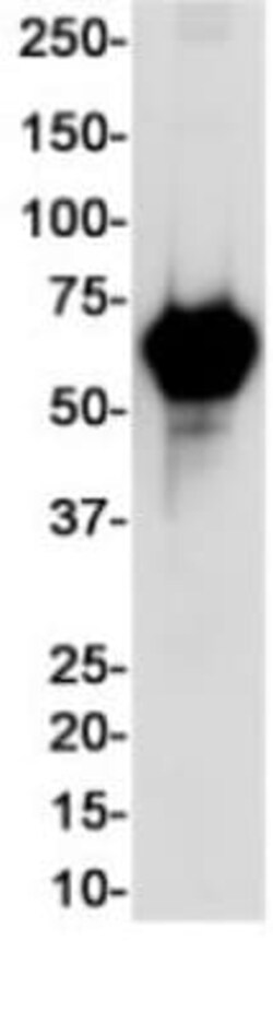 Alkaline Phosphatase/ALPP Antibody (S01-8I3), Novus Biologicals 50 &mu;g;