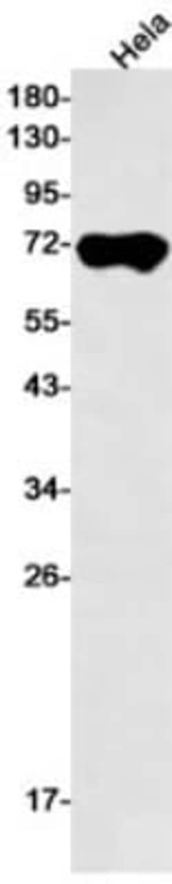 Alkaline Phosphatase/ALPP Antibody (S01-8I3), Novus Biologicals 50 &mu;g;