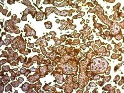 Alkaline Phosphatase/ALPP Antibody (SPM593), Novus Biologicals 0.1mg; Unlabeled:Antibodies,