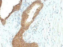 Alkaline Phosphatase, Tissue Non-Specific Antibody (ALPL/597), Novus Biologicals:Antibodies:Primary