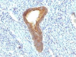 Alkaline Phosphatase, Tissue Non-Specific Antibody (ALPL/597), Novus Biologicals:Antibodies:Primary