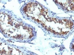 Alkaline Phosphatase, Tissue Non-Specific Antibody (ALPL/597), Novus Biologicals:Antibodies:Primary
