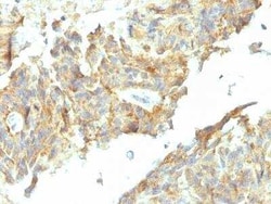 Alkaline Phosphatase, Tissue Non-Specific Antibody (ALPL/597), Novus Biologicals:Antibodies:Primary