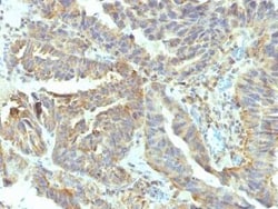 Alkaline Phosphatase, Tissue Non-Specific Antibody (V17.1), Novus Biologicals:Antibodies:Primary