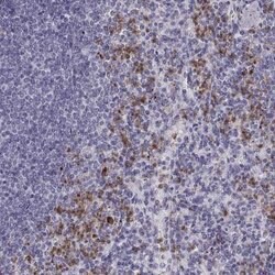 Allergin-1 Antibody, Novus Biologicals:Antibodies:Primary Antibodies