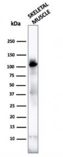 Alpha Actinin 2 Antibody (ACTN2/3292) - Azide and BSA Free, Novus Biologicals