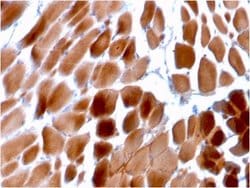 Alpha Actinin 2, Mouse anti-Human, Clone: ACTN2/3292, Novus Biologicals
