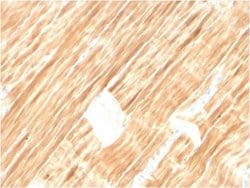 Alpha Actinin 2, Mouse anti-Human, Clone: ACTN2/3292, Novus Biologicals