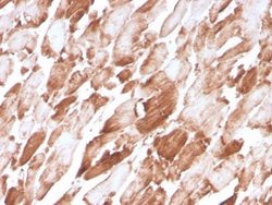 Alpha Actinin 2 Mouse anti-Human, Clone: ACTN2/3294, Novus Biologicals:Anticorps:Anticorps