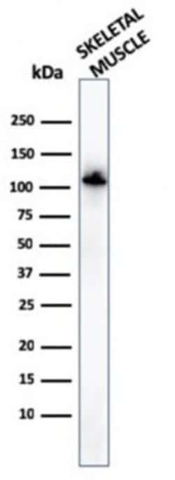 Alpha Actinin 2 Antibody (ACTN2/3294) - Azide and BSA Free, Novus Biologicals 100 &mu;g | Buy Online | Novus Biologicals | Fisher Scientific