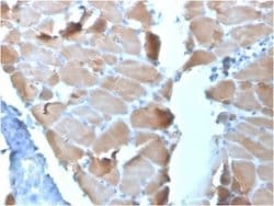 Alpha Actinin 2 Antibody (ACTN2/3295) - Azide and BSA Free, Novus Biologicals 100 &mu;g | Buy Online | Novus Biologicals | Fisher Scientific