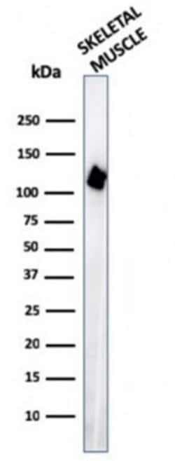 Alpha Actinin 2 Antibody (ACTN2/3295) - Azide and BSA Free, Novus Biologicals 100 &mu;g | Buy Online | Novus Biologicals | Fisher Scientific