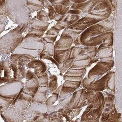 Alpha Actinin 2 Antibody, Novus Biologicals 0.1 mL; Unconjugated:Antibodies,