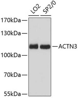 Alpha Actinin 3 Antibody - Azide and BSA Free, Novus Biologicals 0.02 mL,