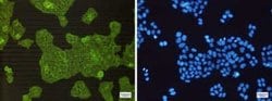 Alpha Actinin 4 Rabbit anti-Human, Mouse, Rat, Clone: S06-3D7, Novus Biologicals:Antibodies:Primary