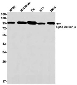 Alpha Actinin 4 Rabbit anti-Human, Mouse, Rat, Clone: S06-3D7, Novus Biologicals:Antibodies:Primary