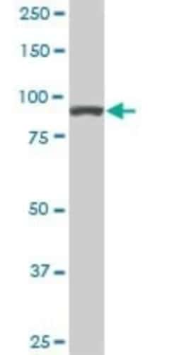 Alpha Actinin 4 Antibody (4D10), Novus Biologicals 0.1 mg | Buy Online | Novus Biologicals | Fisher Scientific