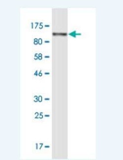 Novus Biologicals Alpha Actinin 4 Antibody (8G12), Novus Biologicals 0.1 mg | Buy Online | Novus Biologicals&trade; | Fisher Scientific