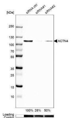 Alpha Actinin 4 Antibody, Novus Biologicals 25 &mu;L; Unconjugated:Antibodies,