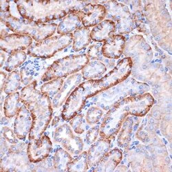 Alpha Fodrin Rabbit anti-Human, Mouse, Rat, Clone: 9H5V8, Novus Biologicals:Antibodies:Primary