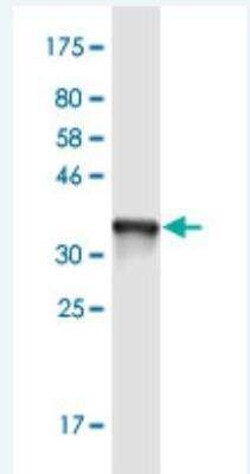 Alpha-TTP Antibody (7B5), Novus Biologicals 50 &mu;g | Buy Online | Novus Biologicals | Fisher Scientific
