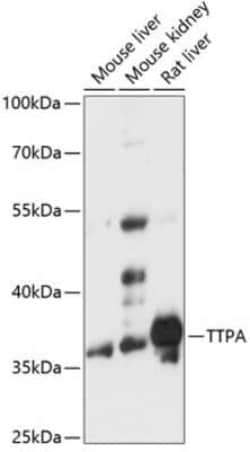 Alpha-TTP Antibody - Azide and BSA Free, Novus Biologicals:Antibodies:Primary