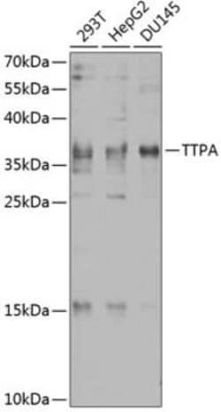 Alpha-TTP Antibody - BSA Free, Novus Biologicals 0.02 mL, Unconjugated:Antibodies,