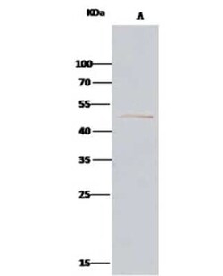Alpha-parvin/Actopaxin Antibody, Novus Biologicals:Antibodies:Primary Antibodies
