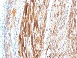 AlphaB Crystallin/CRYAB Antibody (CPTC-CRYAB-1) - Azide and BSA Free, Novus