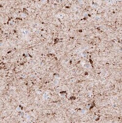 AlphaB Crystallin/CRYAB Antibody (CL10765), Novus Biologicals 25 &mu;g;