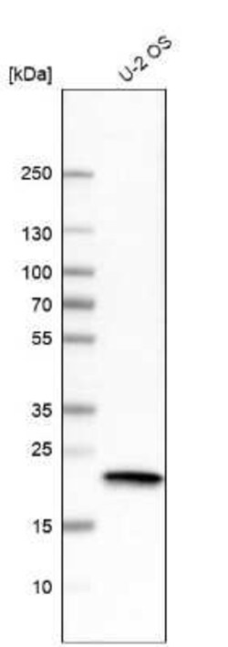 AlphaB Crystallin/CRYAB Antibody (CL10765), Novus Biologicals 25 &mu;g;