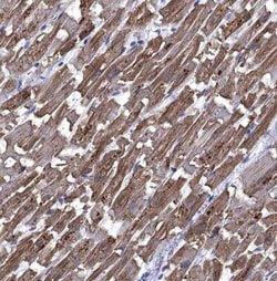 AlphaB Crystallin/CRYAB Antibody, Novus Biologicals 0.1 mL, Unconjugated:Antibodies,