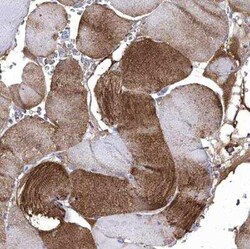 AlphaB Crystallin/CRYAB Antibody, Novus Biologicals 0.1 mL, Unconjugated:Antibodies,