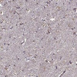 Amiloride-sensitive cation channel 3 Antibody, Novus Biologicals 100 &mu;g;