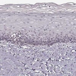Amiloride-sensitive cation channel 3 Antibody, Novus Biologicals 100 &mu;g;