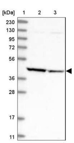 Aminoacylase/ACY1 Antibody, Novus Biologicals 25 &mu;L | Buy Online | Novus Biologicals | Fisher Scientific