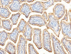 Aminopeptidase N/CD13 Rabbit anti-Mouse, Clone: 101, Novus Biologicals