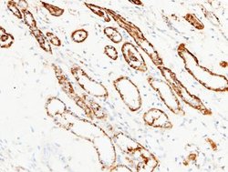 Aminopeptidase N/CD13 Rabbit anti-Human, Clone: 122, Novus Biologicals