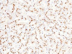 Aminopeptidase N/CD13 Rabbit anti-Human, Clone: 122, Novus Biologicals