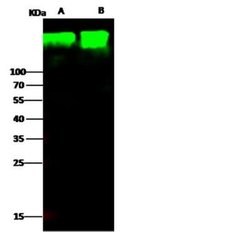 Aminopeptidase N/CD13 Rabbit anti-Human, Clone: 122, Novus Biologicals