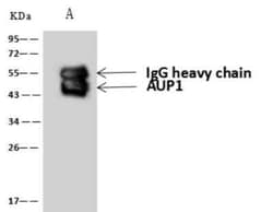 Ancient ubiquitous protein 1 Antibody, Novus Biologicals 100 &mu;g; Unconjugated:Antibodies,