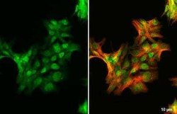 Androgen R/NR3C4 Antibody (HL1028) - ARv7 Variant, Novus Biologicals 100