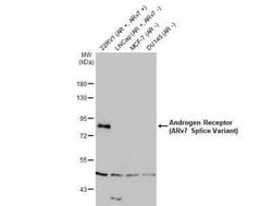 Androgen R/NR3C4 Antibody (HL1028) - ARv7 Variant, Novus Biologicals 100