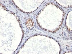 Androgen R/NR3C4 Antibody (AR441), Novus Biologicals:Antibodies:Primary