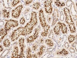Angiogenin Antibody, Novus Biologicals 100 &mu;g, Unconjugated:Antibodies,