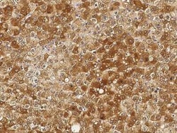 Angiogenin Antibody, Novus Biologicals 100 &mu;g, Unconjugated:Antibodies,