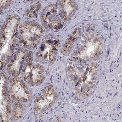 Angiopoietin-1 Antibody, Novus Biologicals:Antibodies:Primary Antibodies